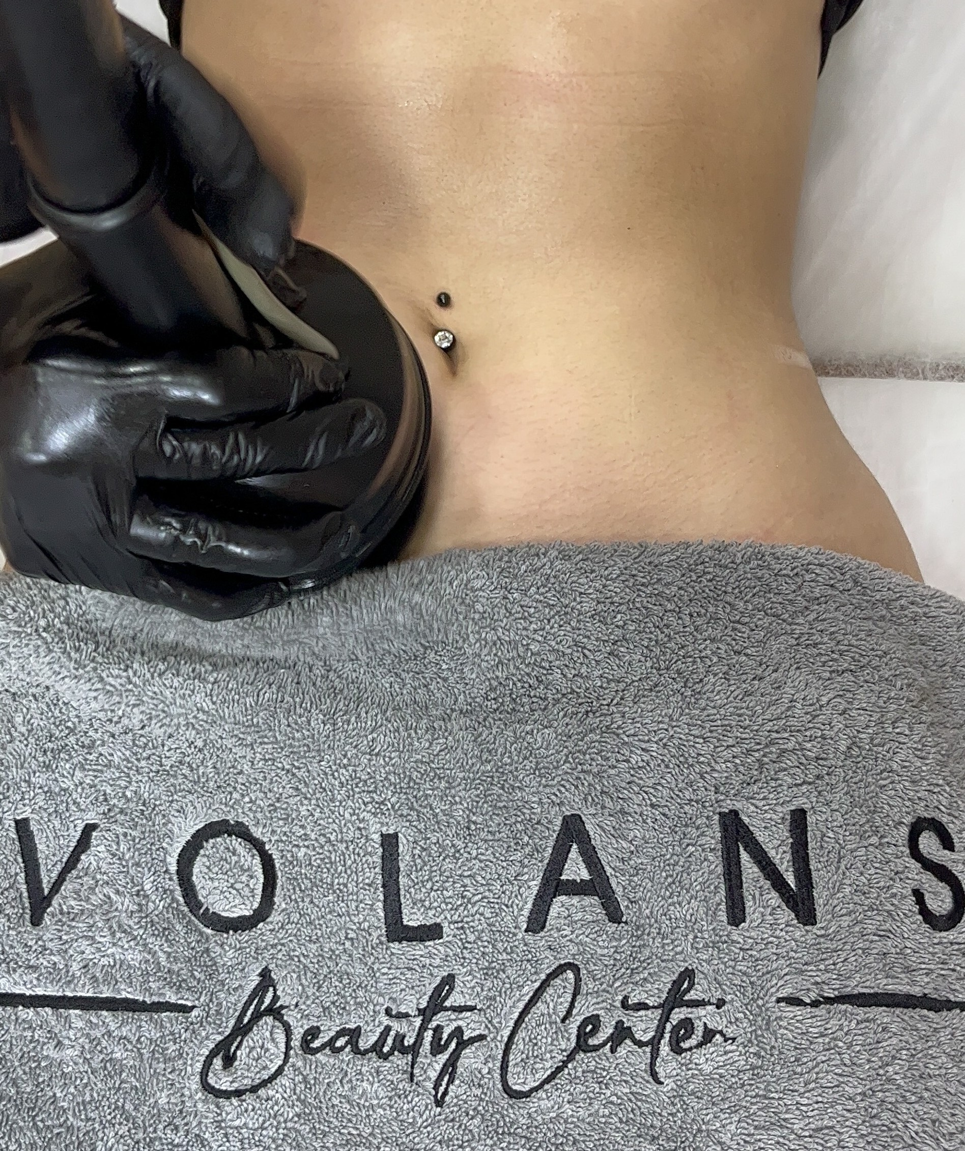 Bağcılar G7 bölgesel incelme ve sıkılaşma Volans Güzellik